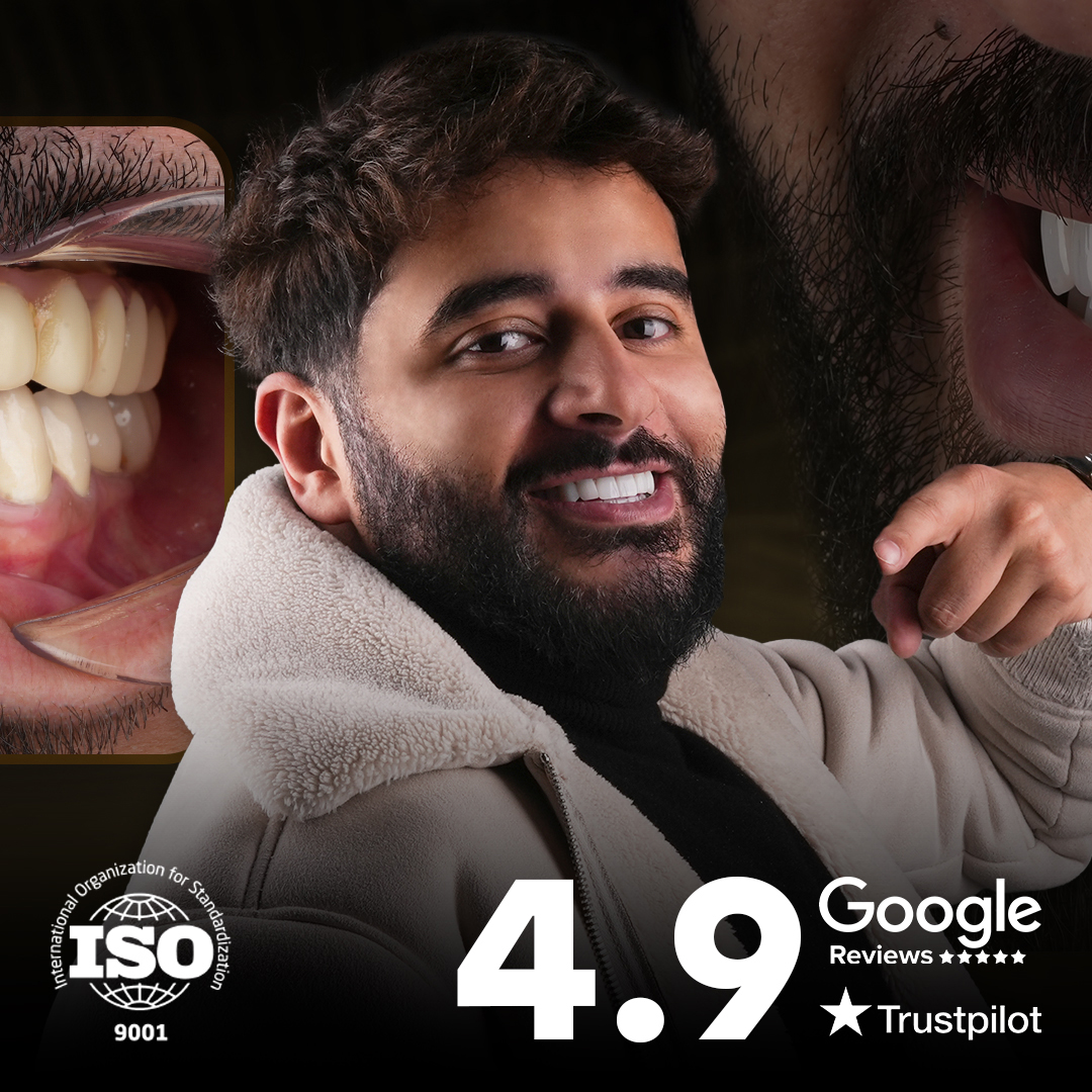 X linked Hypophosphatemia and Dental Damage